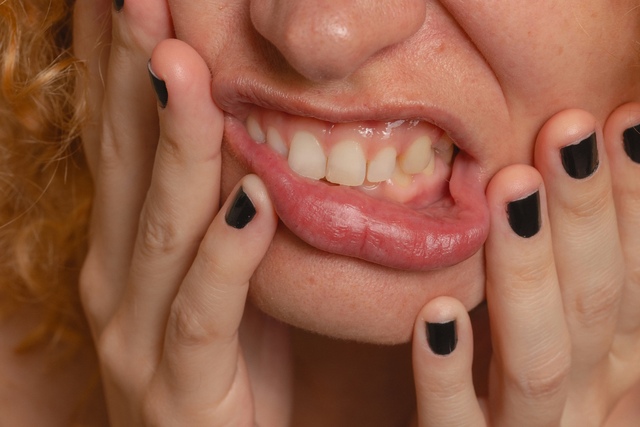 A woman grinding her mouth and teeth